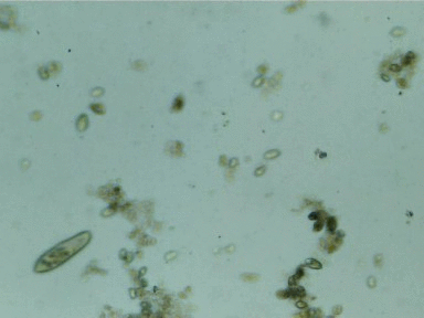 Paramecium caudatum - ciliate-shoes