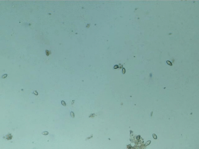 Paramecium caudatum - ciliate-shoes